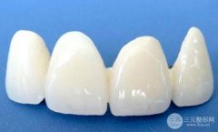 美容冠多少钱一颗？一口好牙很重要！