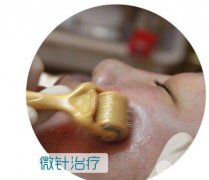 微针痘坑几次有果？祛痘美肤的方法还是ta靠谱！