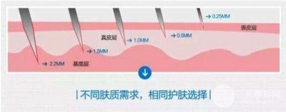 微针痘坑几次有果