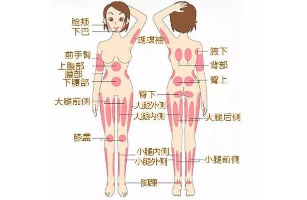 很多人关心的:怎么样溶脂吸脂?原来是这样操作的