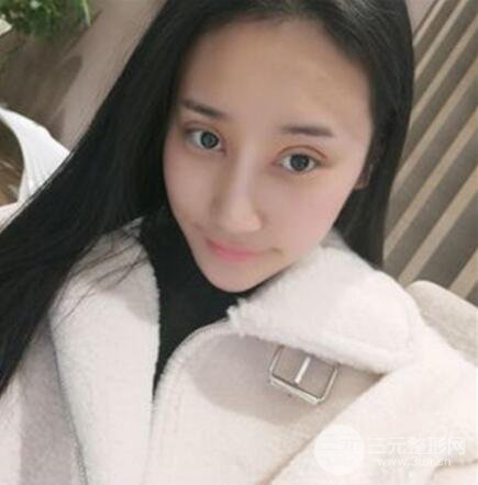 案例介绍