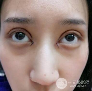 案例介绍