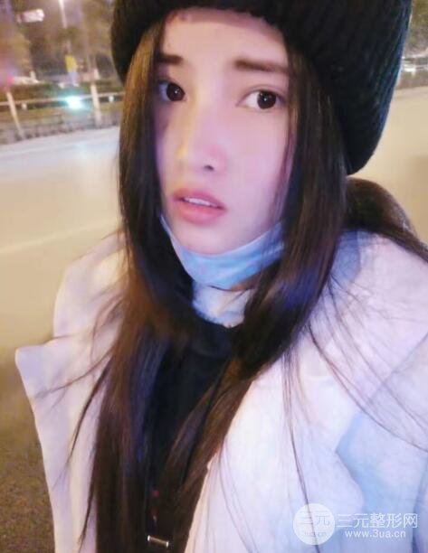 上海九院姚敏祛斑经历祛斑术后190天真实果反馈