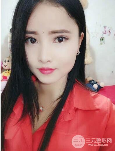 上海九院姚敏祛斑经历祛斑术后190天真实果反馈