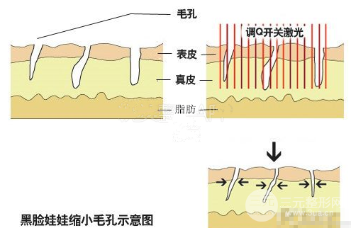 黑脸娃娃对比果