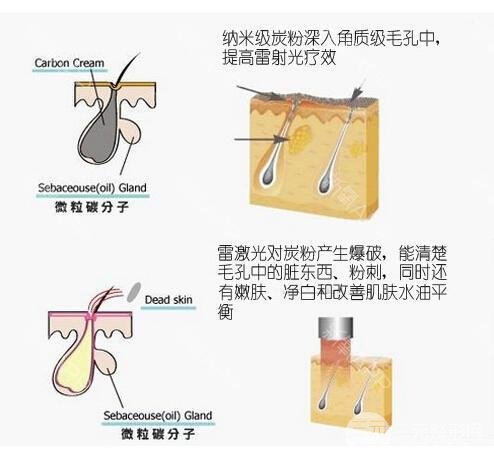 黑脸娃娃对比果