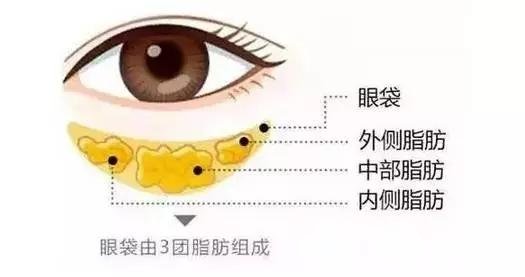 消除眼袋的方式