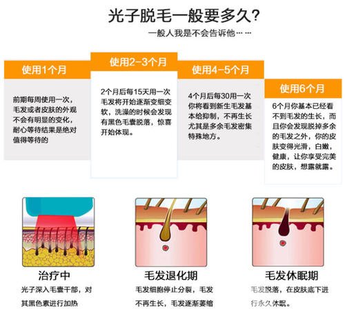 激光脱毛之后需要注意什么？