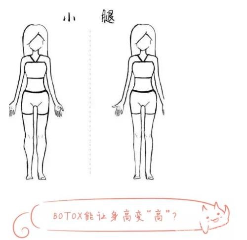****注射瘦腿后需要注意什么?