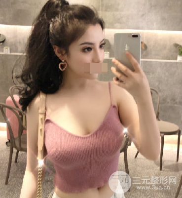 水滴型假体隆胸和圆形假体