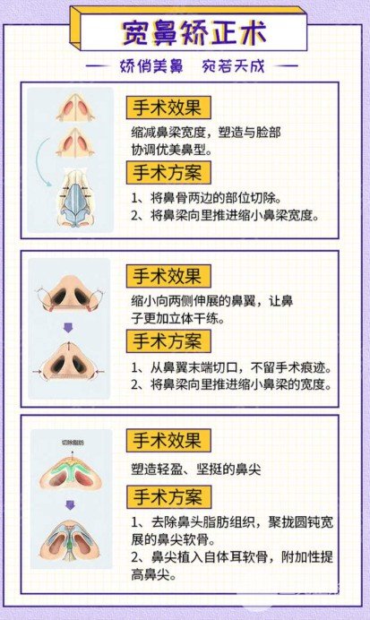 歪鼻矫正术价格