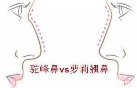 驼峰鼻修复精油