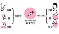 面颊填充术前后对比，一针变不老女神的秘密~
