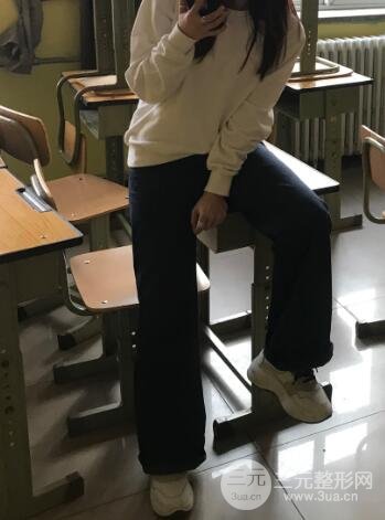 吸脂塑形对比图