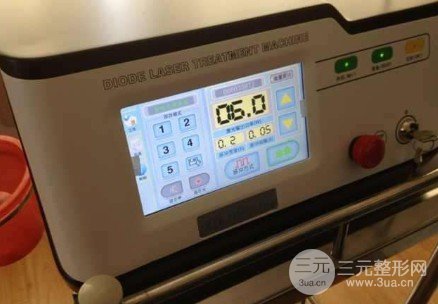 面部光纤溶脂有什么副作用吗