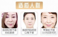 拉皮除皱术能保持几年:永远胜过同龄人~ 拉皮除皱术能保持几年:永远胜过同龄人~