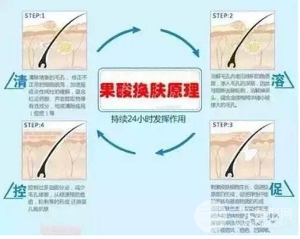 果酸焕肤价格