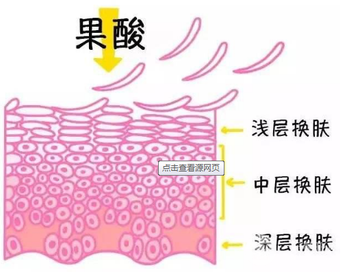 果酸焕肤价格