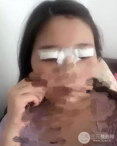 新星靓刘风卓眼修复