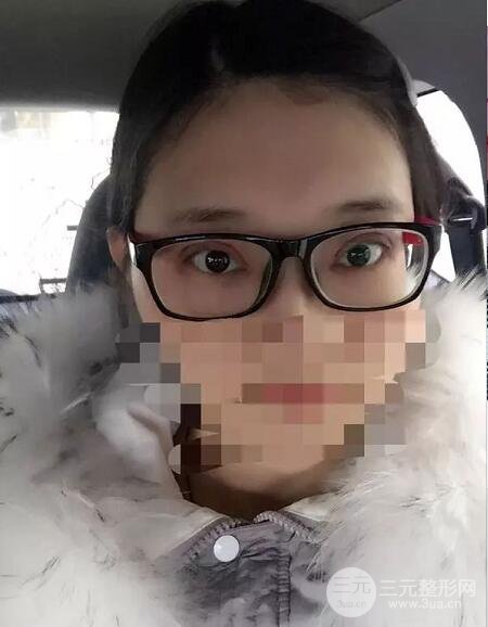 新星靓刘风卓眼修复
