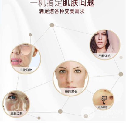 opt嫩肤的原理