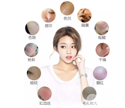 opt嫩肤的原理