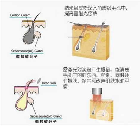 白瓷娃娃美白费用