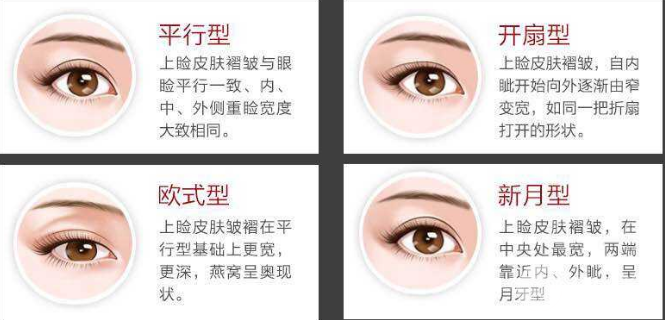 微创双眼皮多少钱