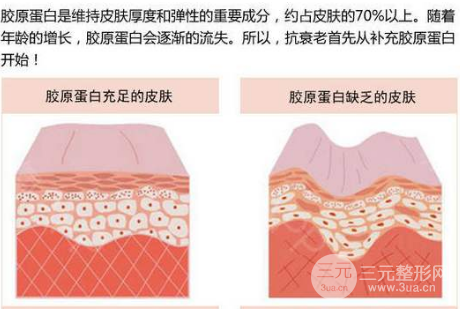 脸部哪些部位可以注射胶原蛋白美容