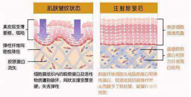 脸部哪些部位可以注射胶原蛋白美容