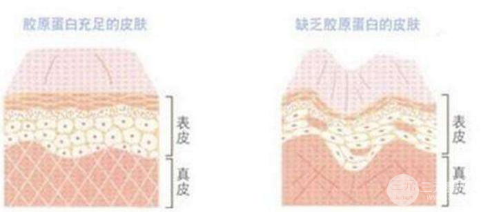 脸部哪些部位可以注射胶原蛋白美容