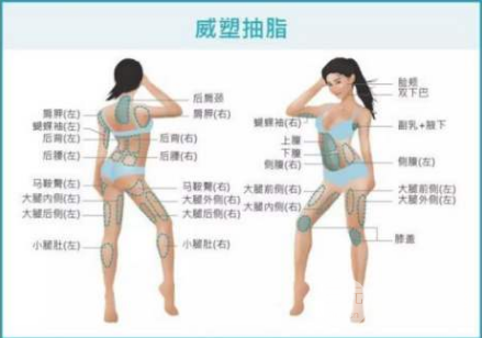 威塑抽脂和水动力吸脂区别