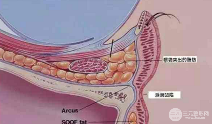 玻尿酸填泪沟隔多久打一次?