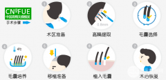广州植发一般多少钱？发际线高怎么改良？