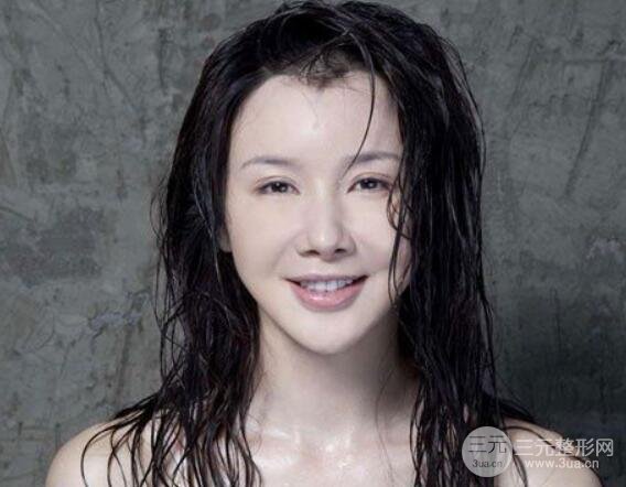 假体隆鼻的危害和后遗症