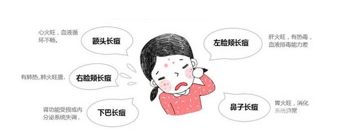 像素激光祛痘果怎么样