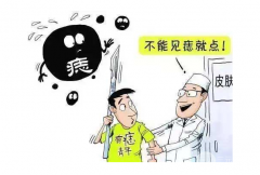 冷冻去痣价格贵吗？不做“痣多星”