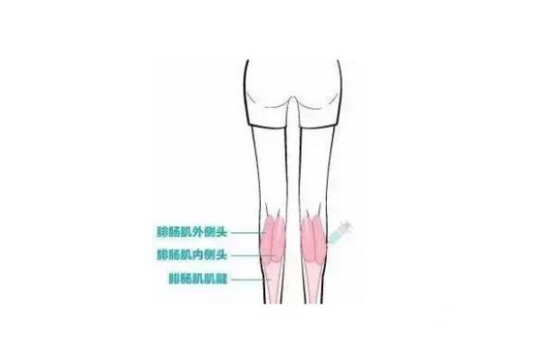 注射瘦脸注射瘦腿果维持时间
