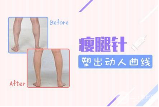 注射瘦脸注射瘦腿果维持时间