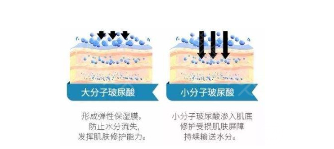 北京大玻尿酸多少钱