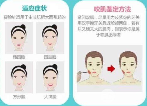 注射瘦脸大概多少钱