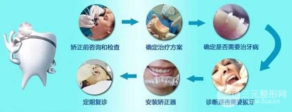北京协和医院口腔医生提示牙齿矫正术后护理方法