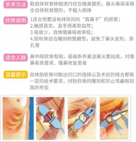 全肋软骨隆鼻整形