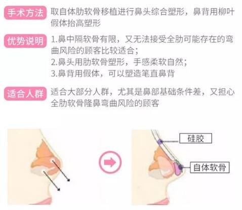半肋软骨隆鼻