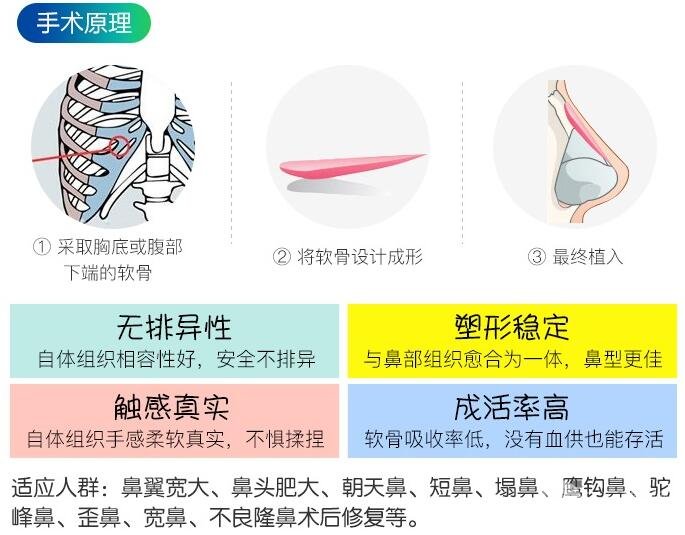 肋软骨做鼻子