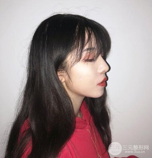 肋软骨做鼻子案例欣赏