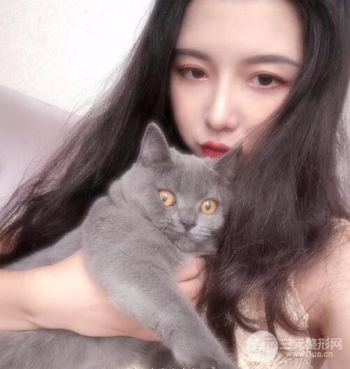 肋软骨做鼻子案例欣赏