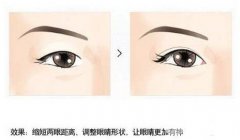什么人适合开眼角?担心开了眼角不好看这篇文章种草一下