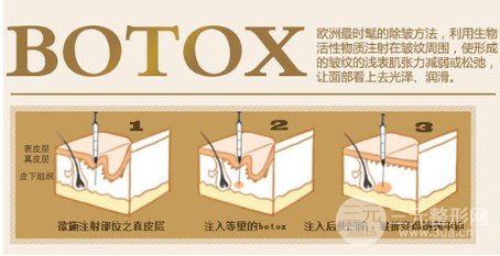 注射****注射瘦脸注意