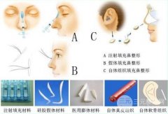 隆鼻假体材料有哪些,假体材料利弊分析 隆鼻假体材料有哪些,假体材料利弊分析